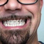 Logo du groupe Achieving Reliable Freshness for Your Single Teeth at DoctorPrem